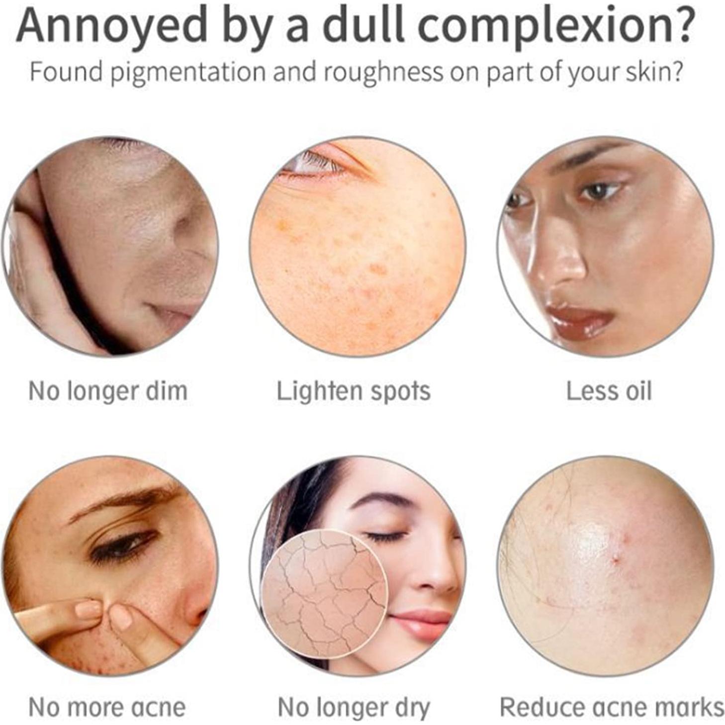 Mascarilla Facial AICHUN BEAUTY Arcilla Helada 100g Fresa y Leche