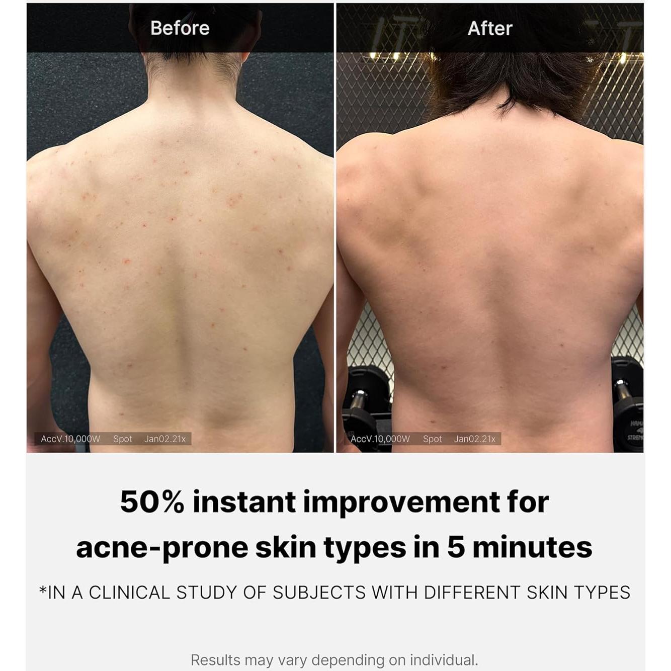 Medicube Lavado Corporal 414 ml - Limpiador Hidratante con Ácido Salicílico y Niacinamida