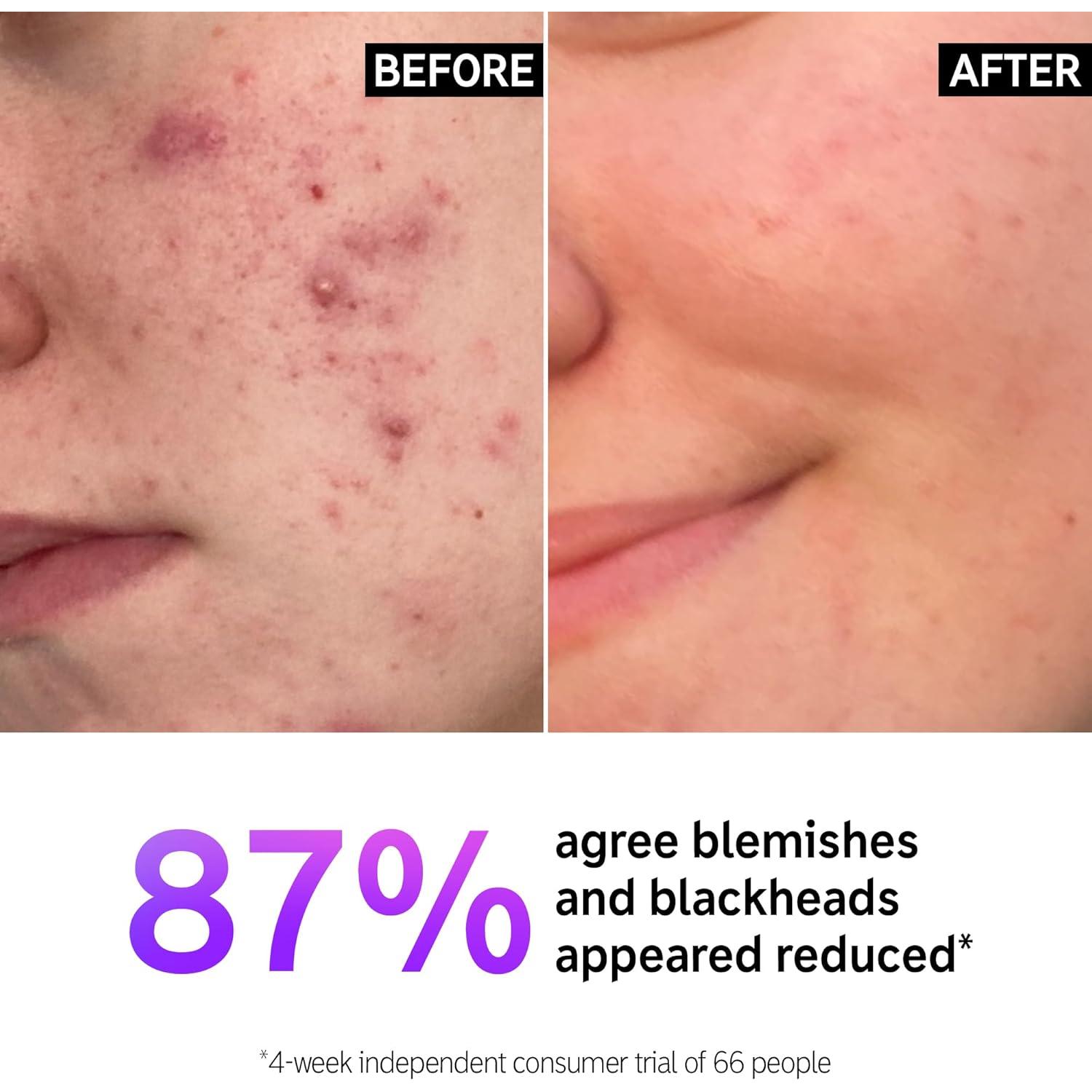 Limpiador Facial Ácido Salicílico The INKEY List 150 ml