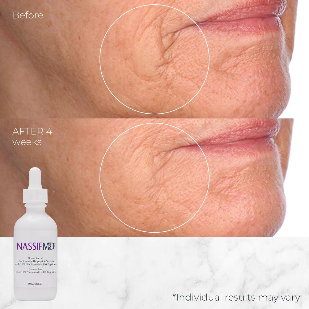 Suero Facial NassifMD Niacinamida 10% con Biopeptidos 30ml