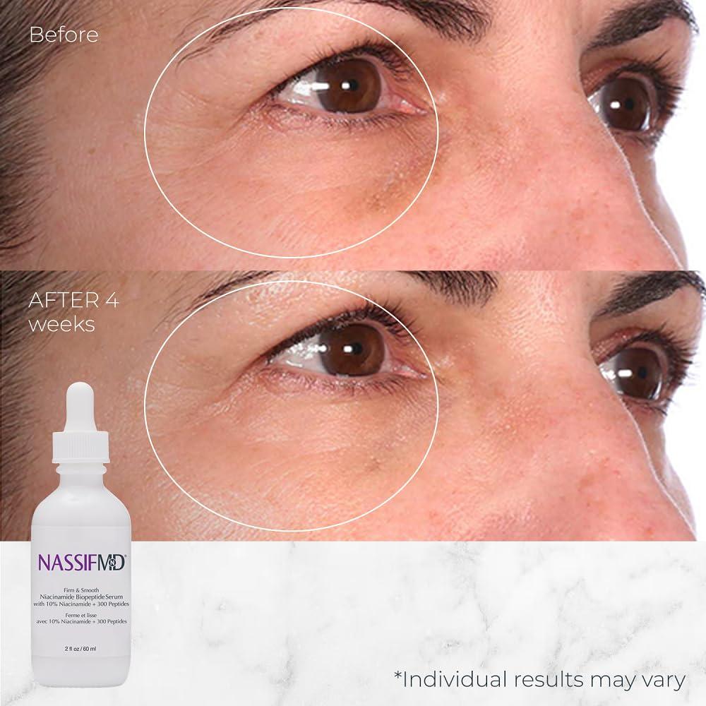 Suero Facial NassifMD Niacinamida 10% con Biopeptidos 30ml