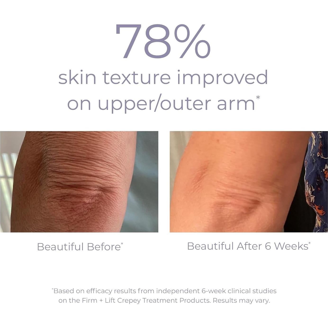 Crema Corporal Hidratante Derma E para Piel Crepey 170 g