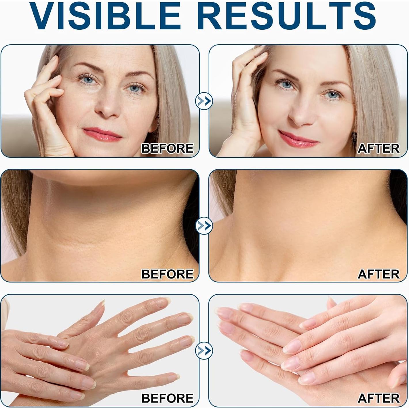 Suero Reafirmante de Retinol Wlytech 28.35g - Antiarrugas