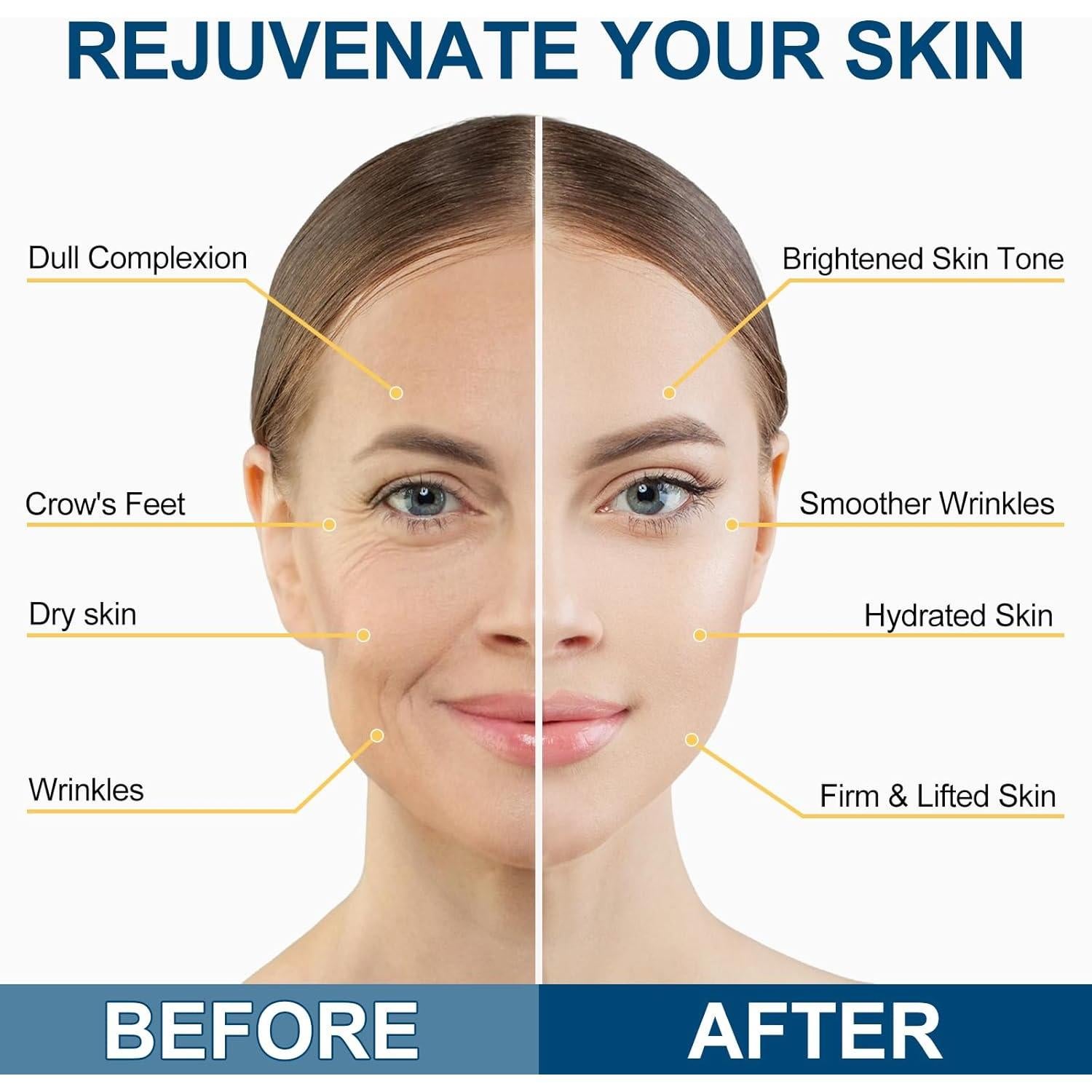 Suero Reafirmante de Retinol Wlytech 28.35g - Antiarrugas