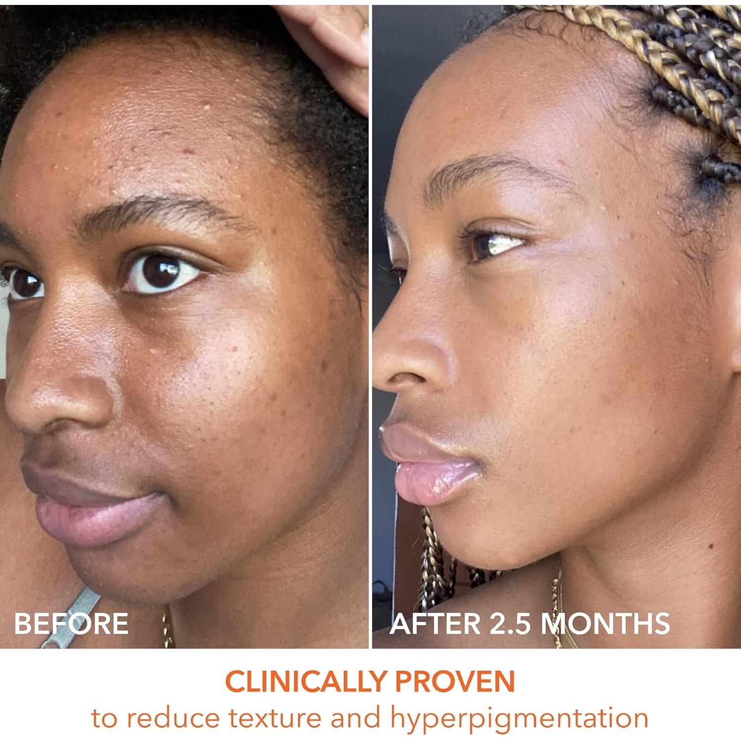 Alpha Beta Daily Peel Dr. Dennis Gross 60 Pads Unisex