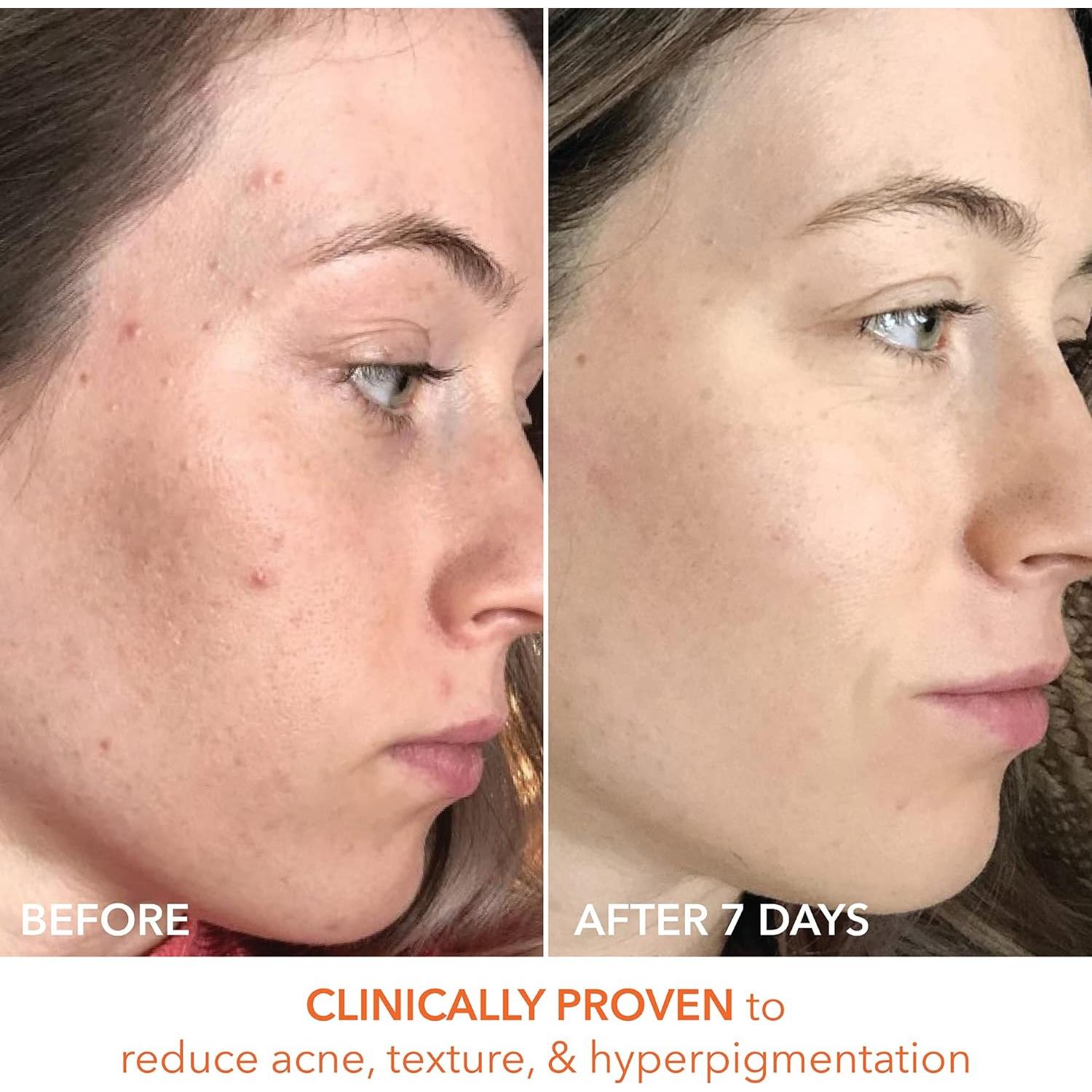 Alpha Beta Daily Peel Dr. Dennis Gross 60 Pads Unisex