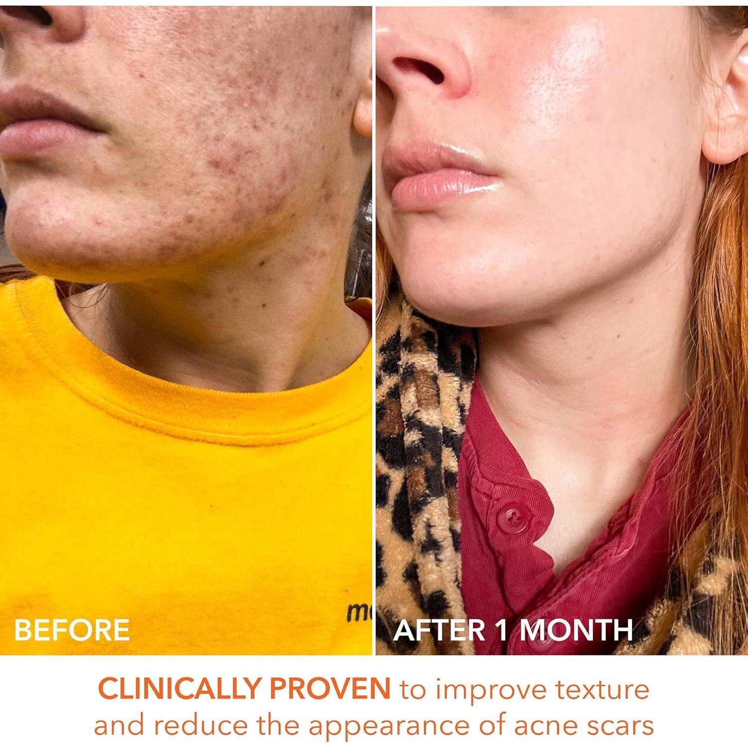 Alpha Beta Daily Peel Dr. Dennis Gross 60 Pads Unisex