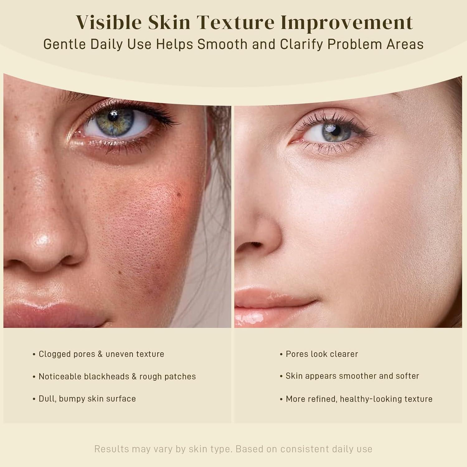 Almohadillas de Limpieza Facial AOPO con Ácido Kójico y Cúrcuma - 50 Pcs