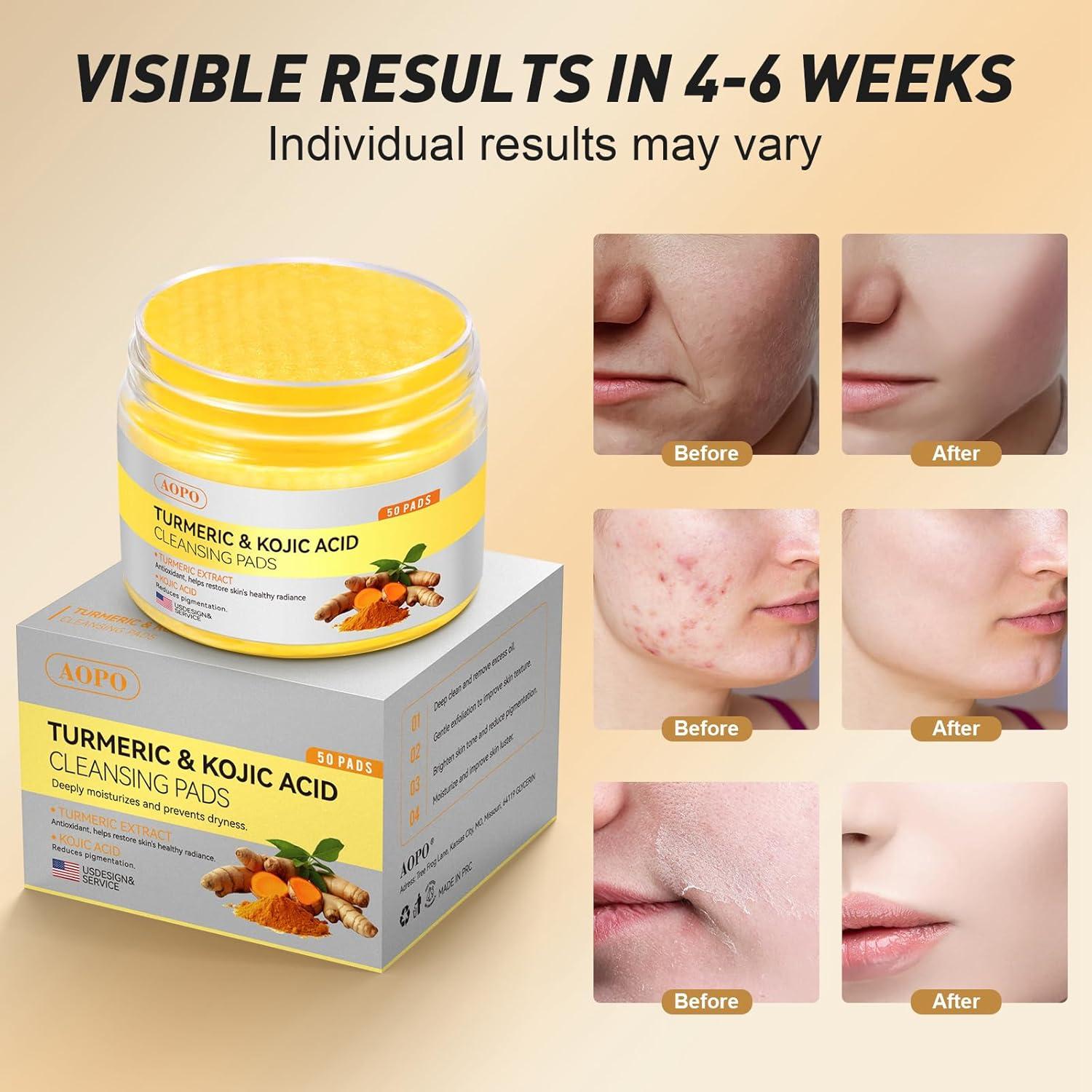 Almohadillas de Limpieza Facial AOPO con Ácido Kójico y Cúrcuma - 50 Pcs