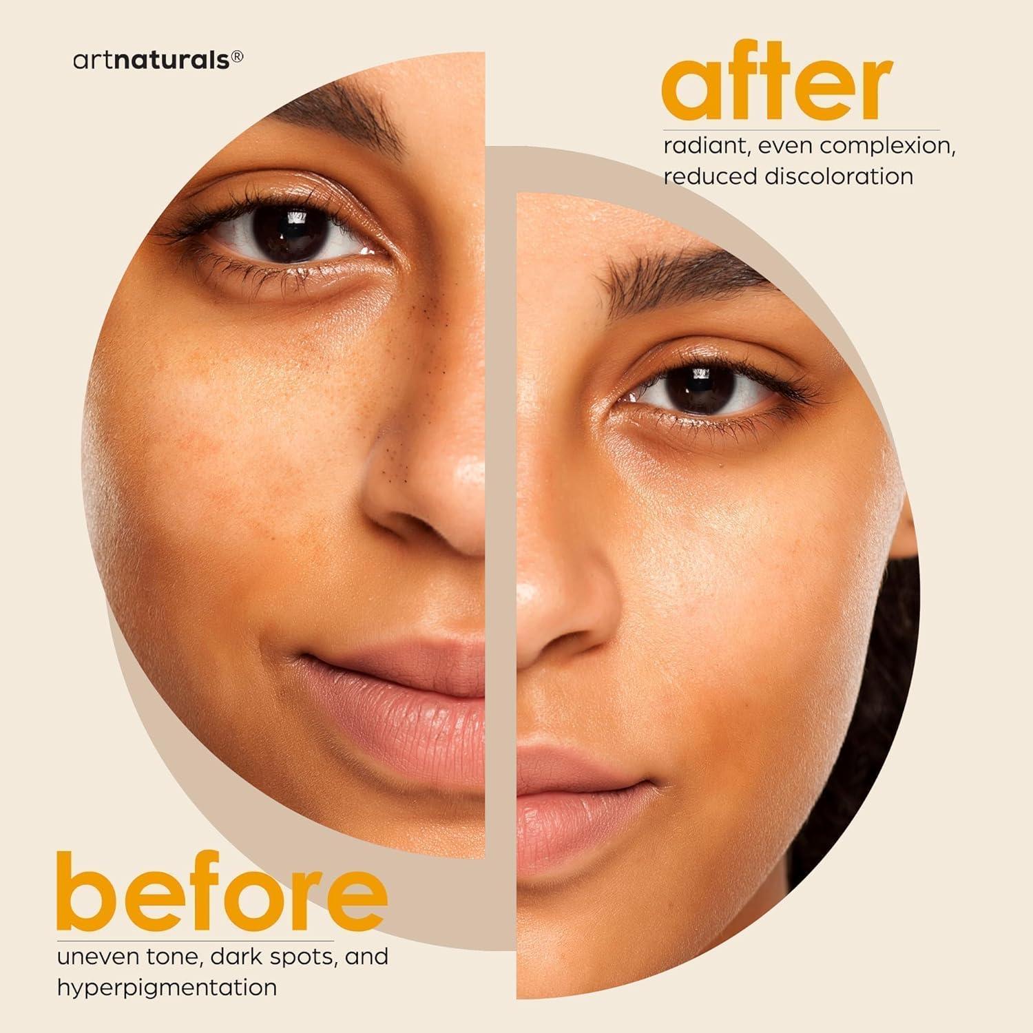 Jabón Ácido Kójico Artnaturals + Esponja Africana 2x142g