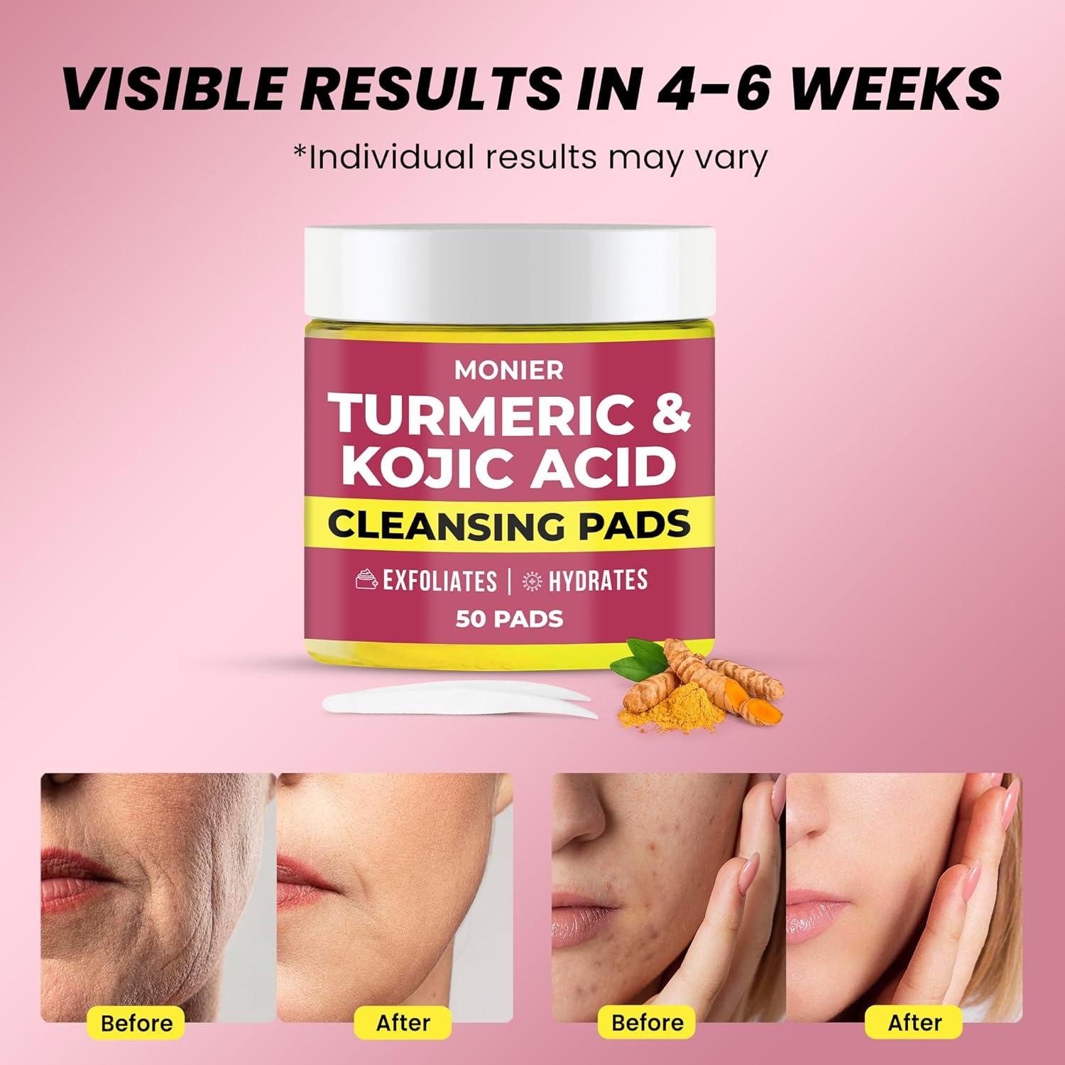 Discos Limpiadores MONIER con Ácido Kójico y Cúrcuma - 50 Unidades