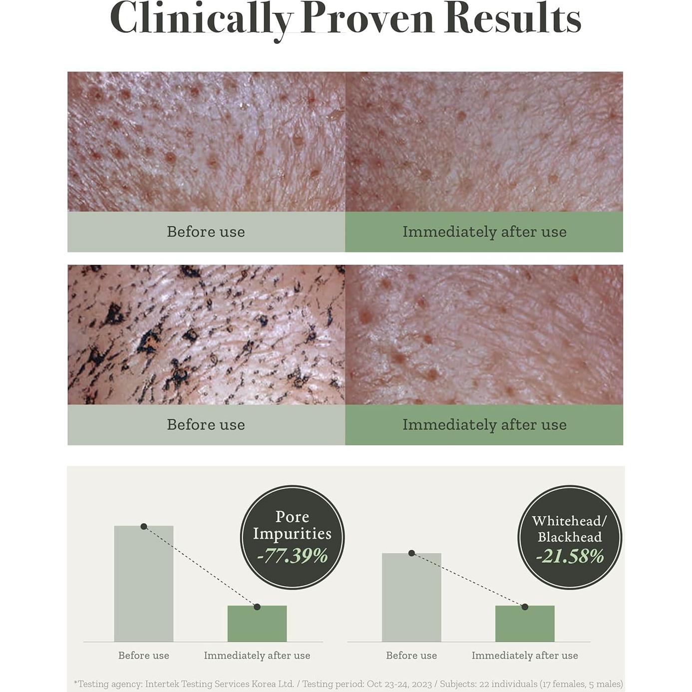 Kit de Cuidado Facial Fully con Extracto de Tomate Verde - Hidratación y Reducción de Poros