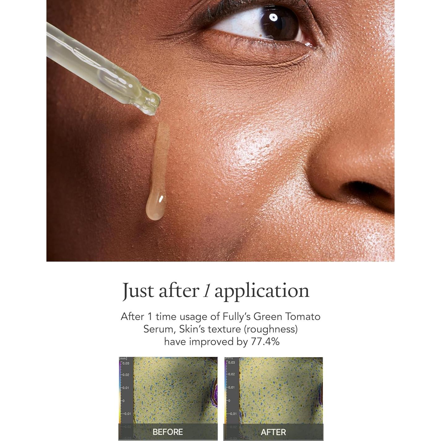 Kit de Cuidado Facial Fully con Extracto de Tomate Verde - Hidratación y Reducción de Poros