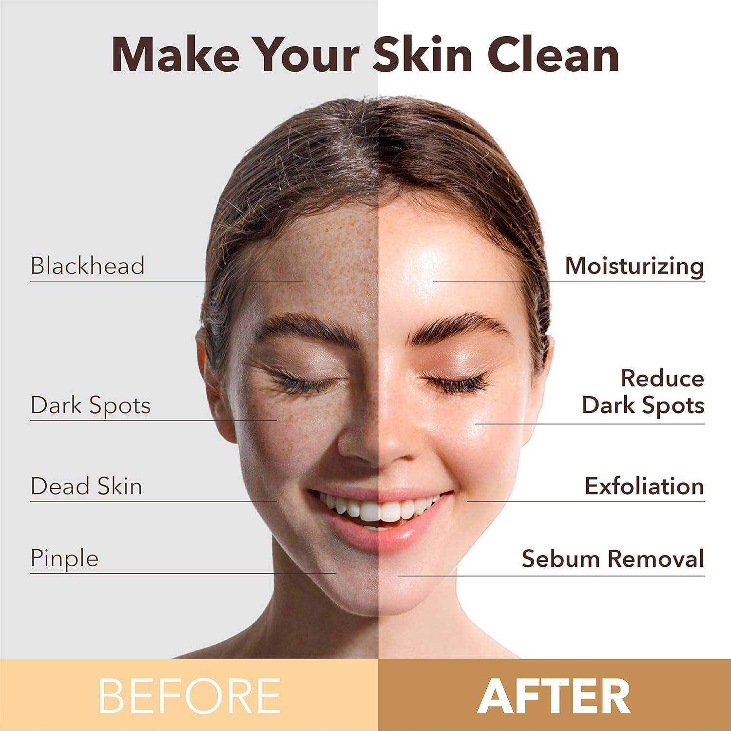 Mascarilla Burbujeante Purificante Verde O2 PUREDERM 5ea 25g