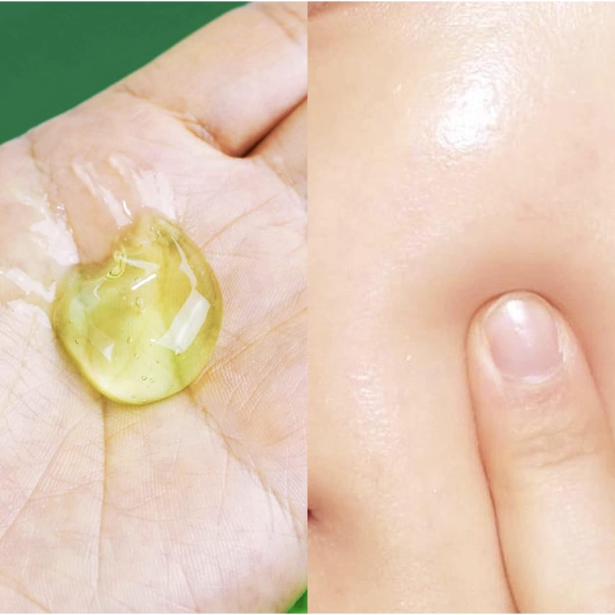 Gel de Aloe Vera 100% Calmante y Hidratante Mido 300g