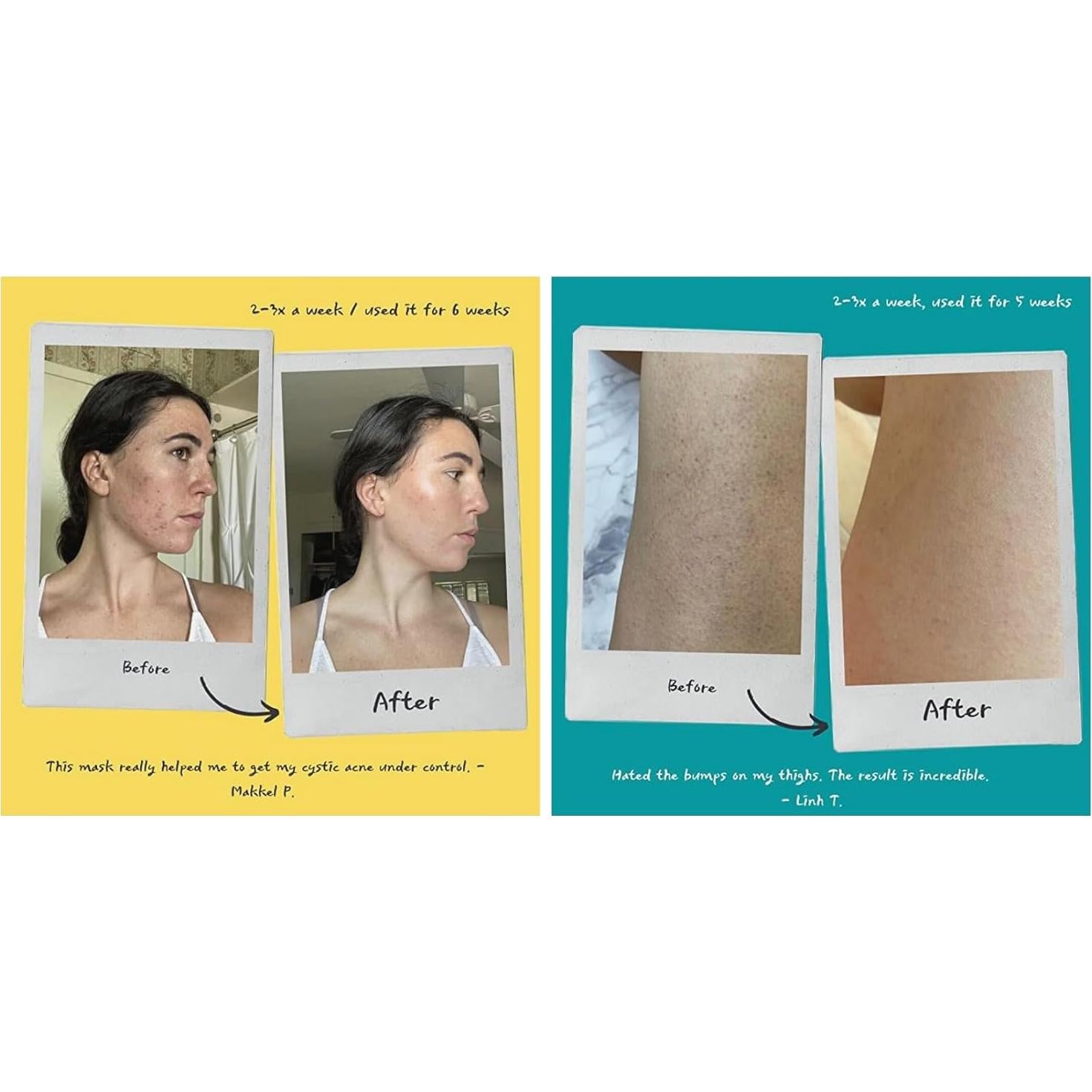 Exfoliante Facial y Corporal Fytt 226g con Col Rizada