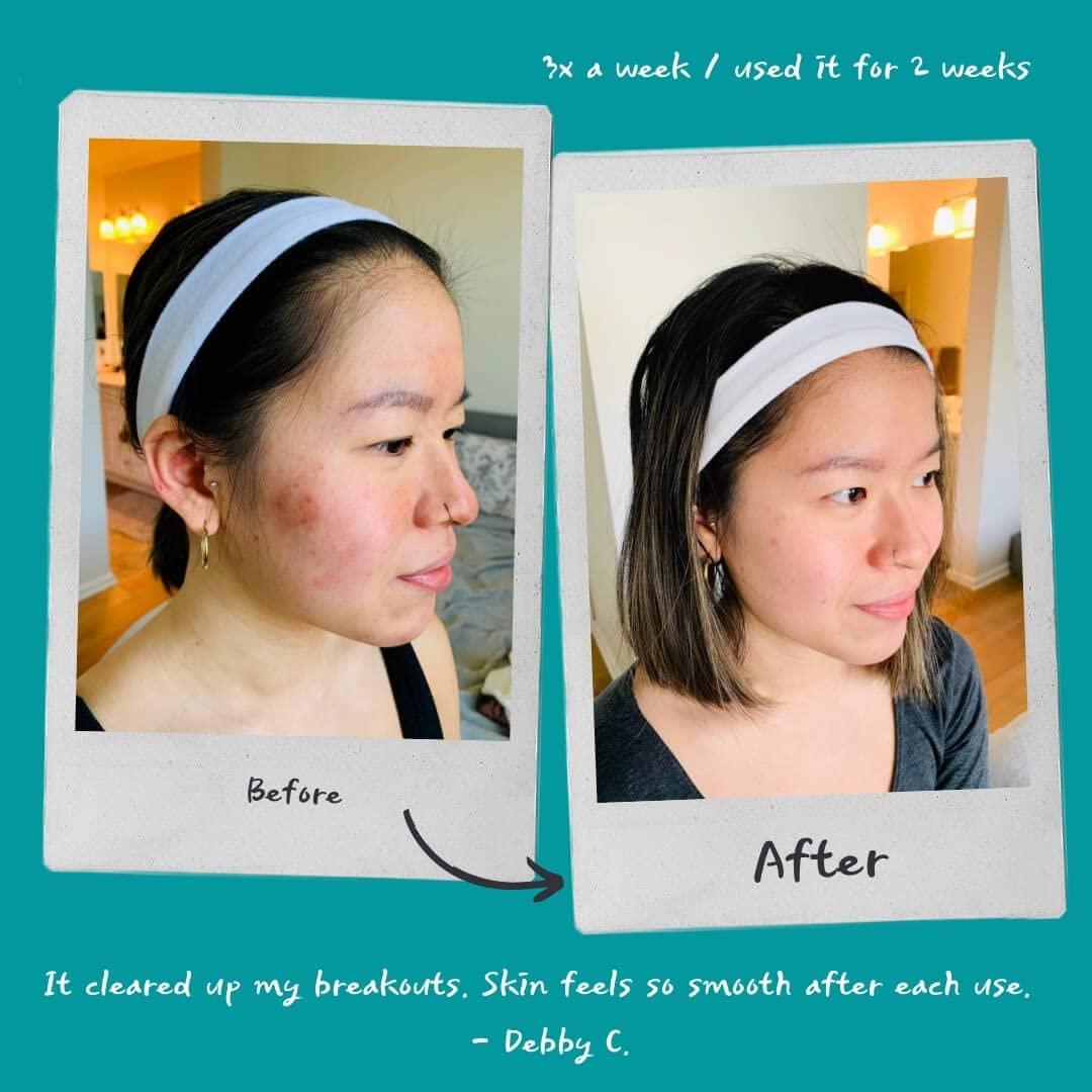 Exfoliante Facial y Corporal Fytt 226g con Col Rizada