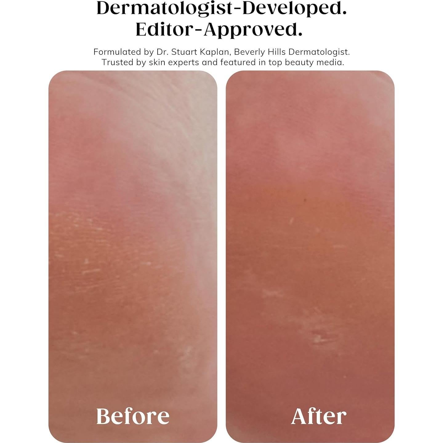 Exfoliante Corporal Kaplan MD Gommage 300 ml con Ácido Glicólico