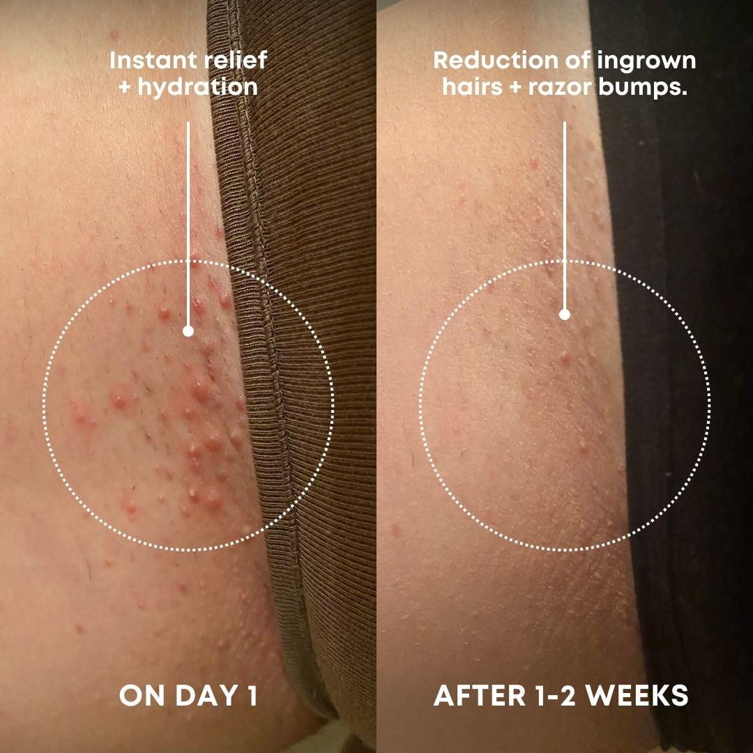 Exfoliante Corporal Bushbalm Azúcar de Sandía 227g - Vellos Encarnados