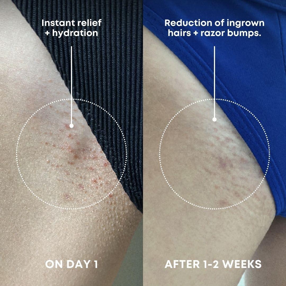 Exfoliante Corporal Bushbalm Azúcar de Sandía 227g - Vellos Encarnados