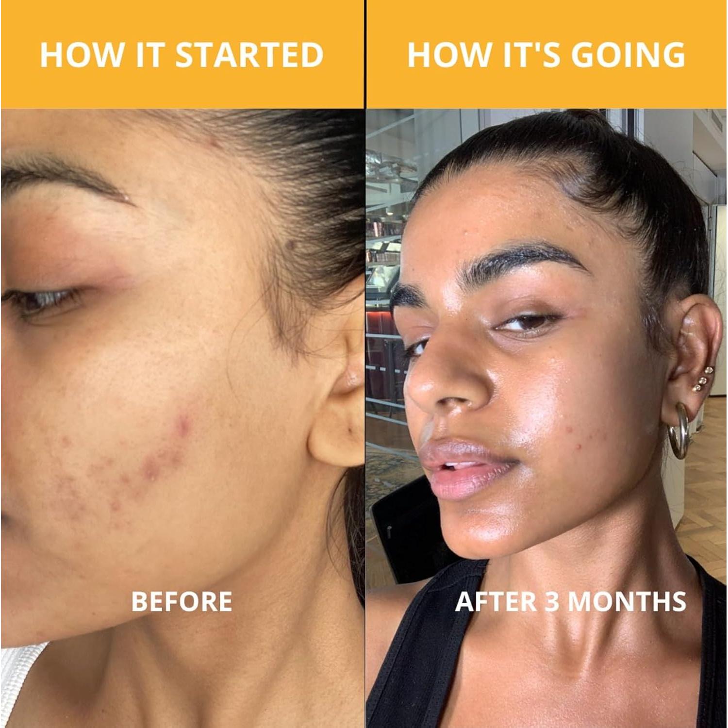 Mascarilla Facial de Arcilla TUMERI con Cúrcuma y Vitamina C 56.7g