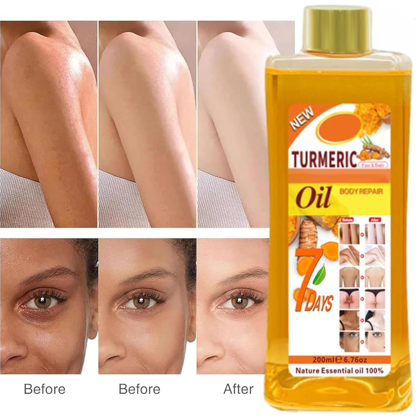 Aceite de Cúrcuma Gtrwadd 167g Hidratante Natural para Piel