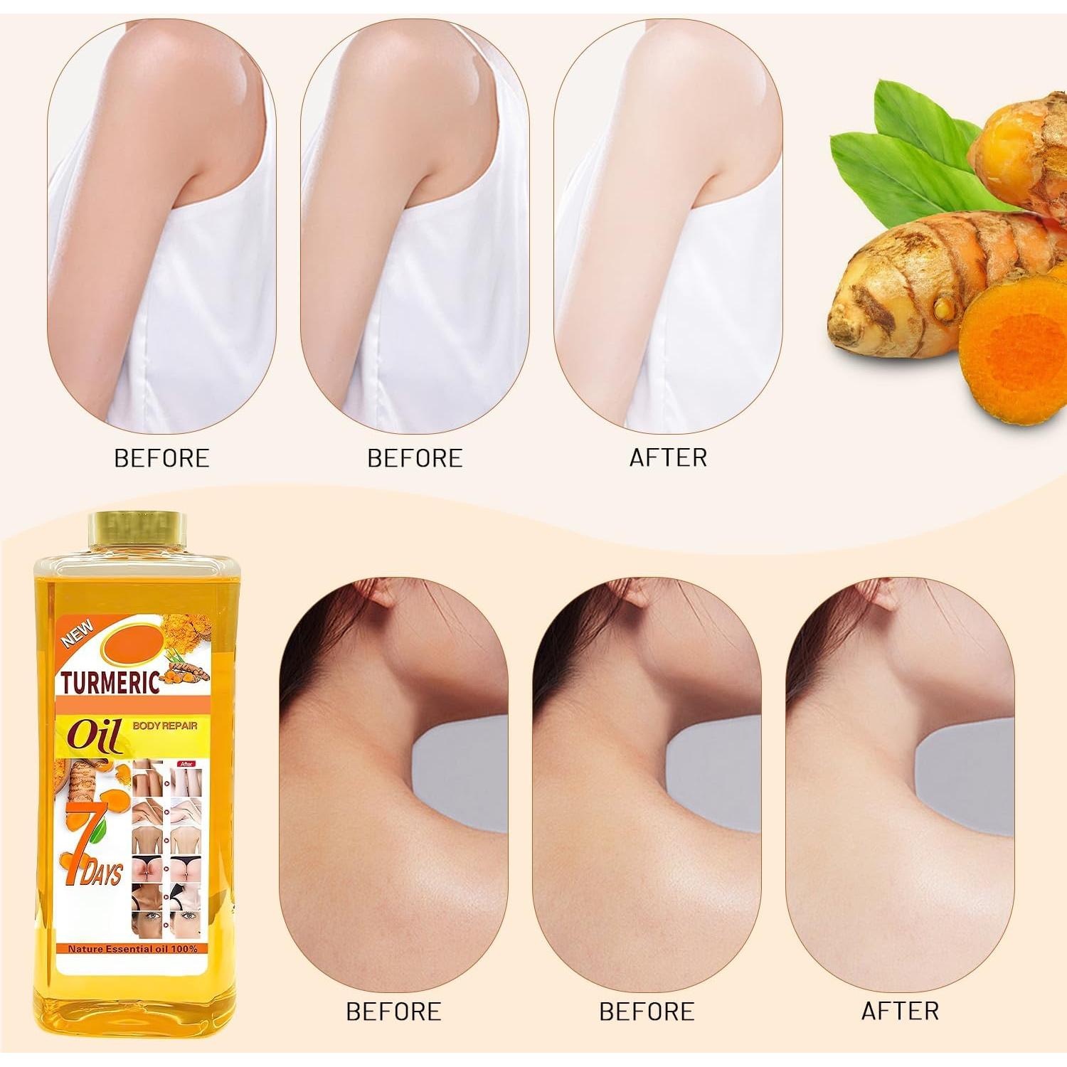 Aceite de Cúrcuma Soft 7 198.4 ml - Hidratante Natural para Piel