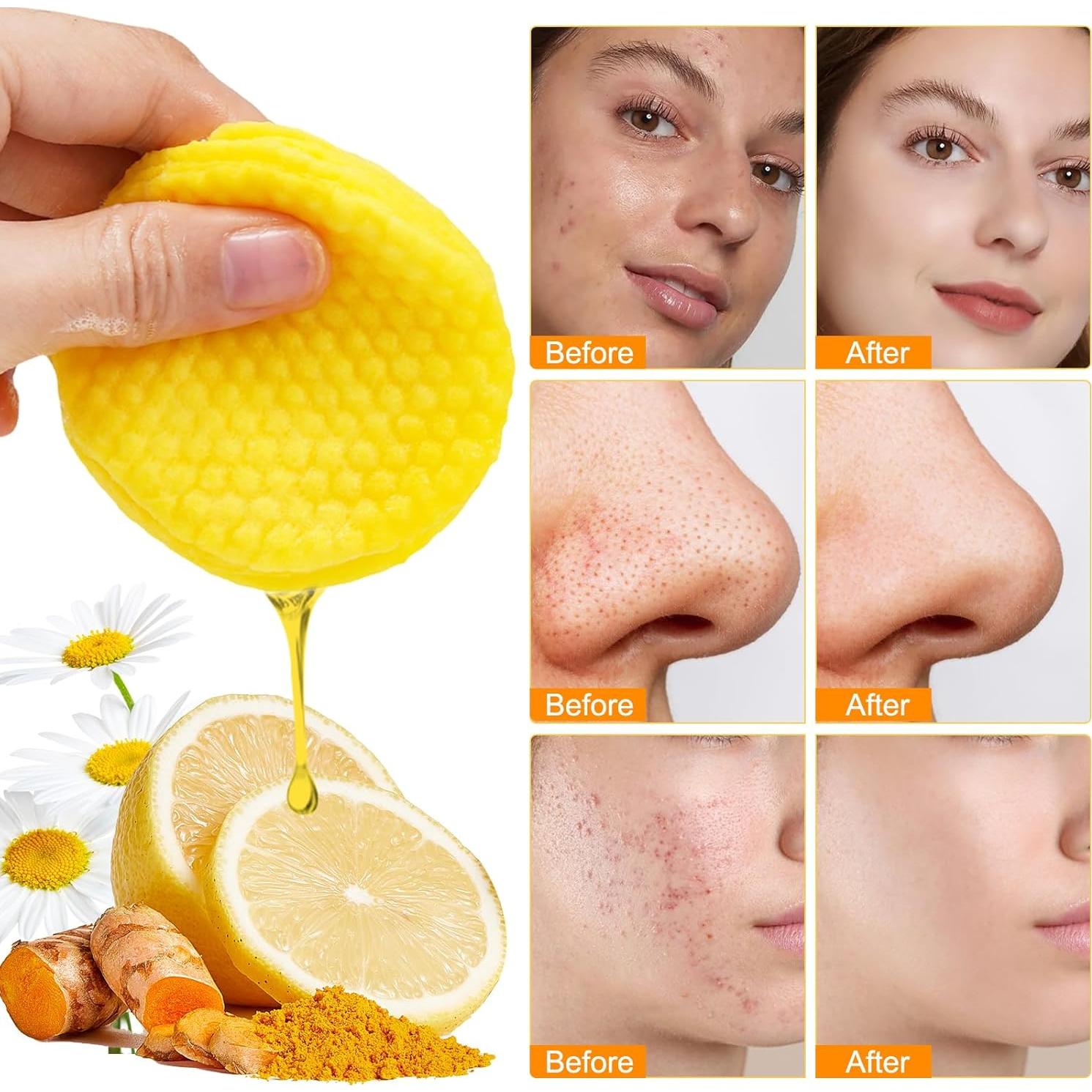 Discos Limpiadores de Cúrcuma ReliCo 50 Unidades Exfoliantes