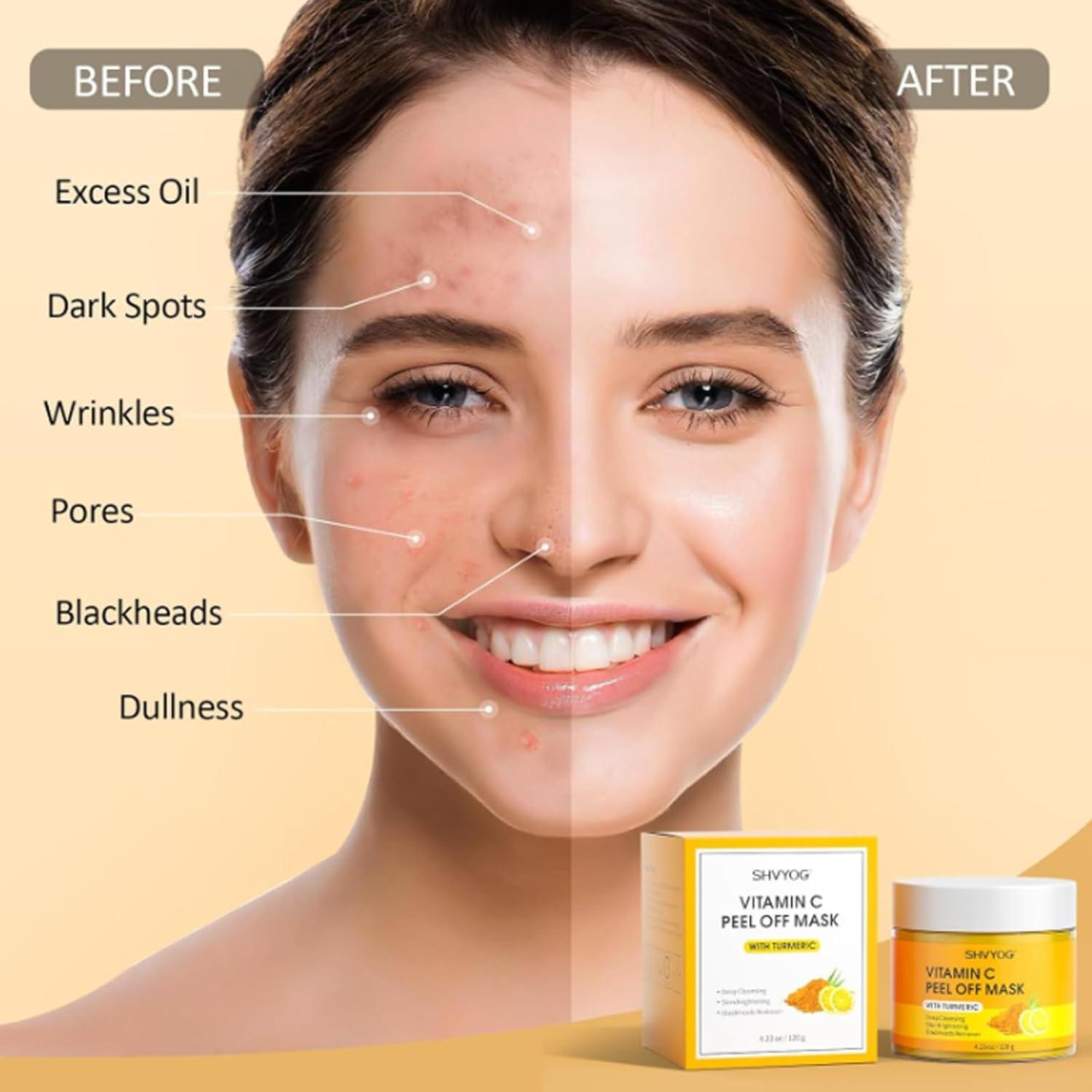 Mascarilla Facial Peel Off Beautyturess Vitamina C y Cúrcuma 2 Pcs