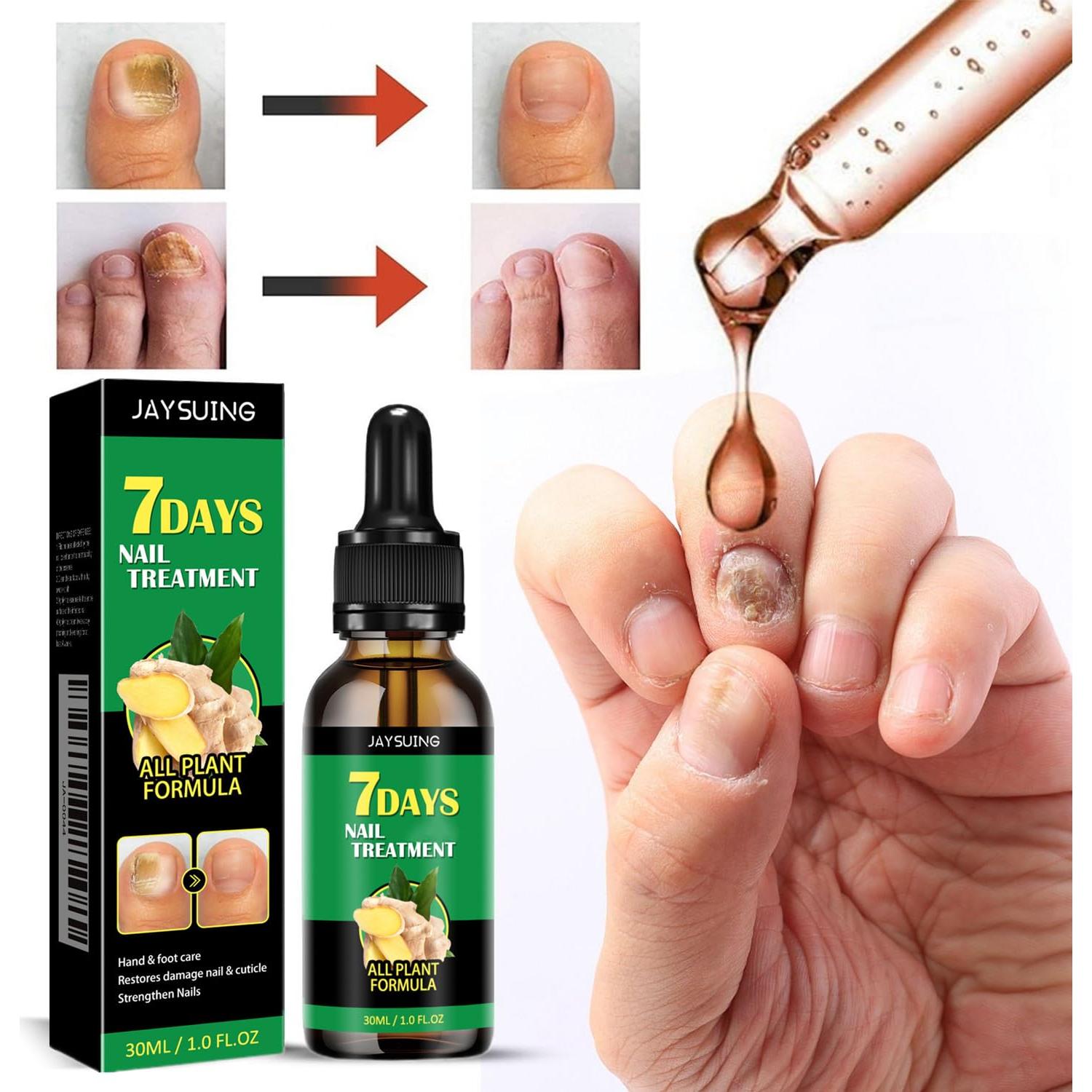 Suero de Crecimiento de Uñas de Jengibre LOYOTICE 30ml