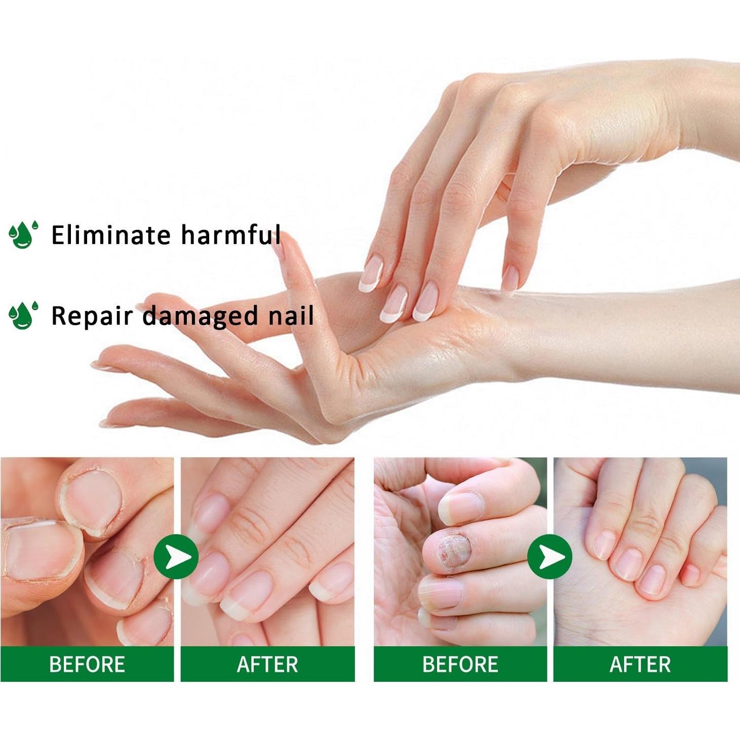 Suero de Crecimiento de Uñas de Jengibre LOYOTICE 30ml