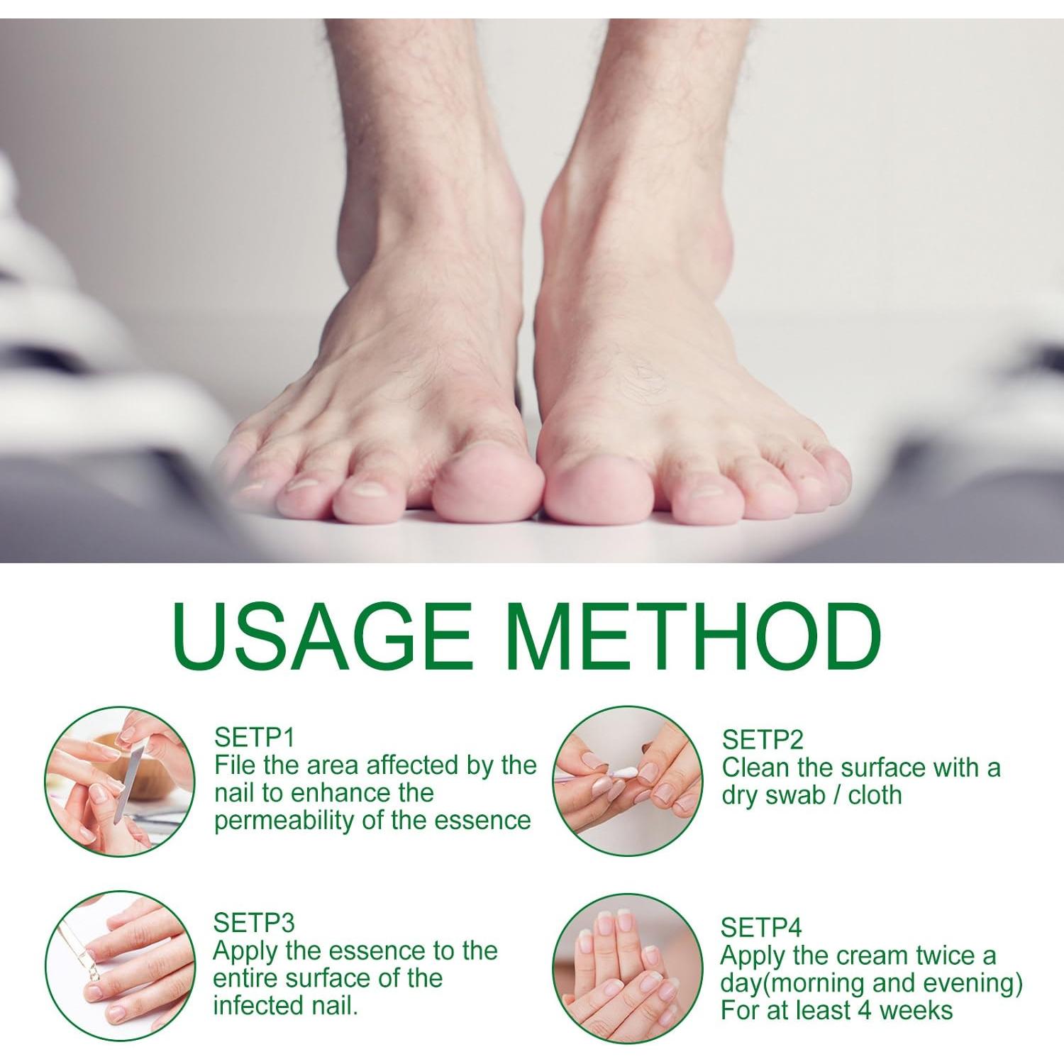 Suero de Crecimiento de Uñas de Jengibre LOYOTICE 30ml