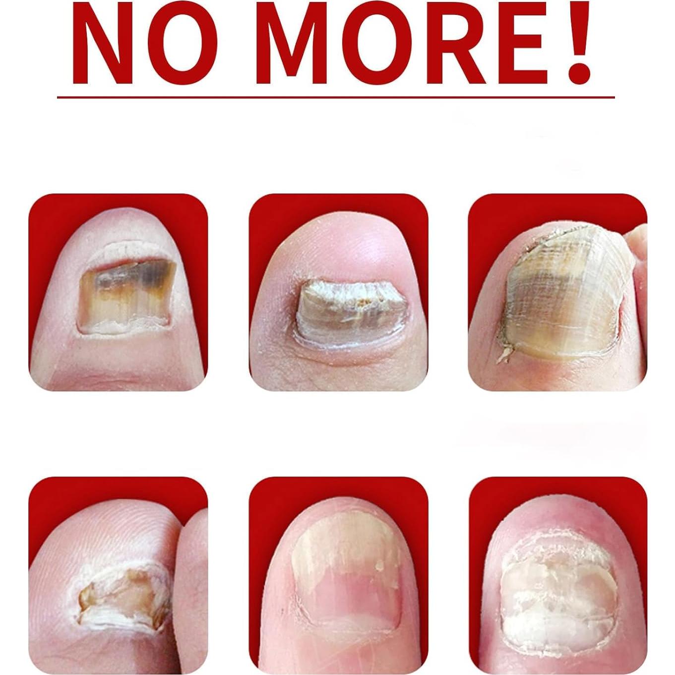 Suero de Crecimiento de Uñas de Jengibre 29.57 ml - Cuidado Cutículas