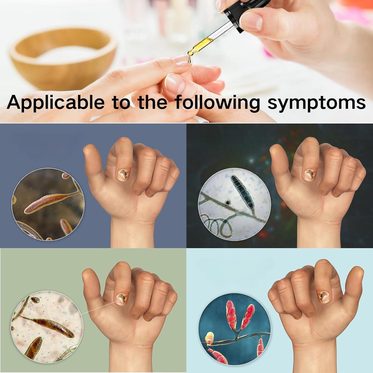 Suero de Cuidado de Uñas de Jengibre ZJRC 3PCS - Hidratante y Fortalecedor