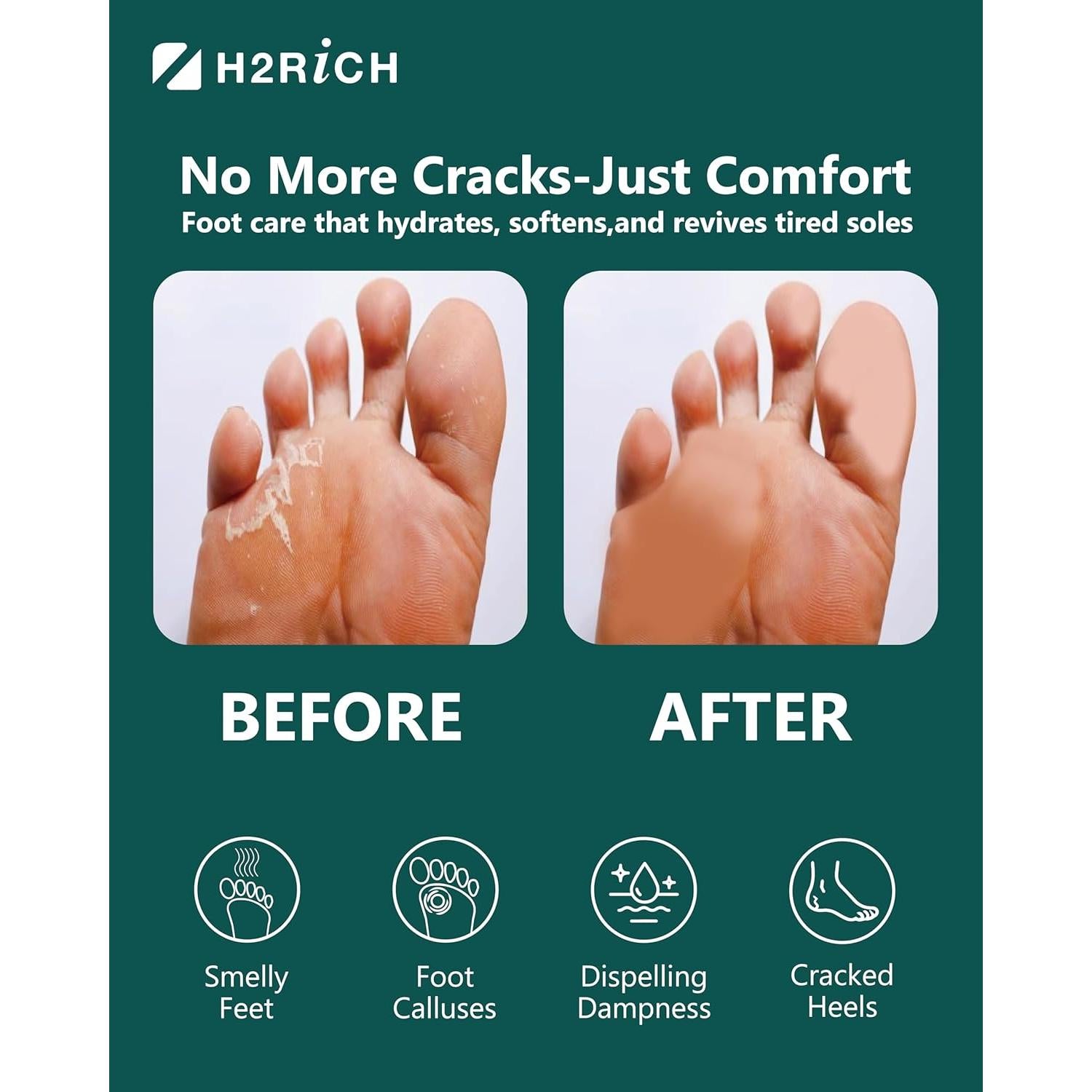 Tabletas de Baño de Pies H2RICH - 3 Paquetes Suavizantes