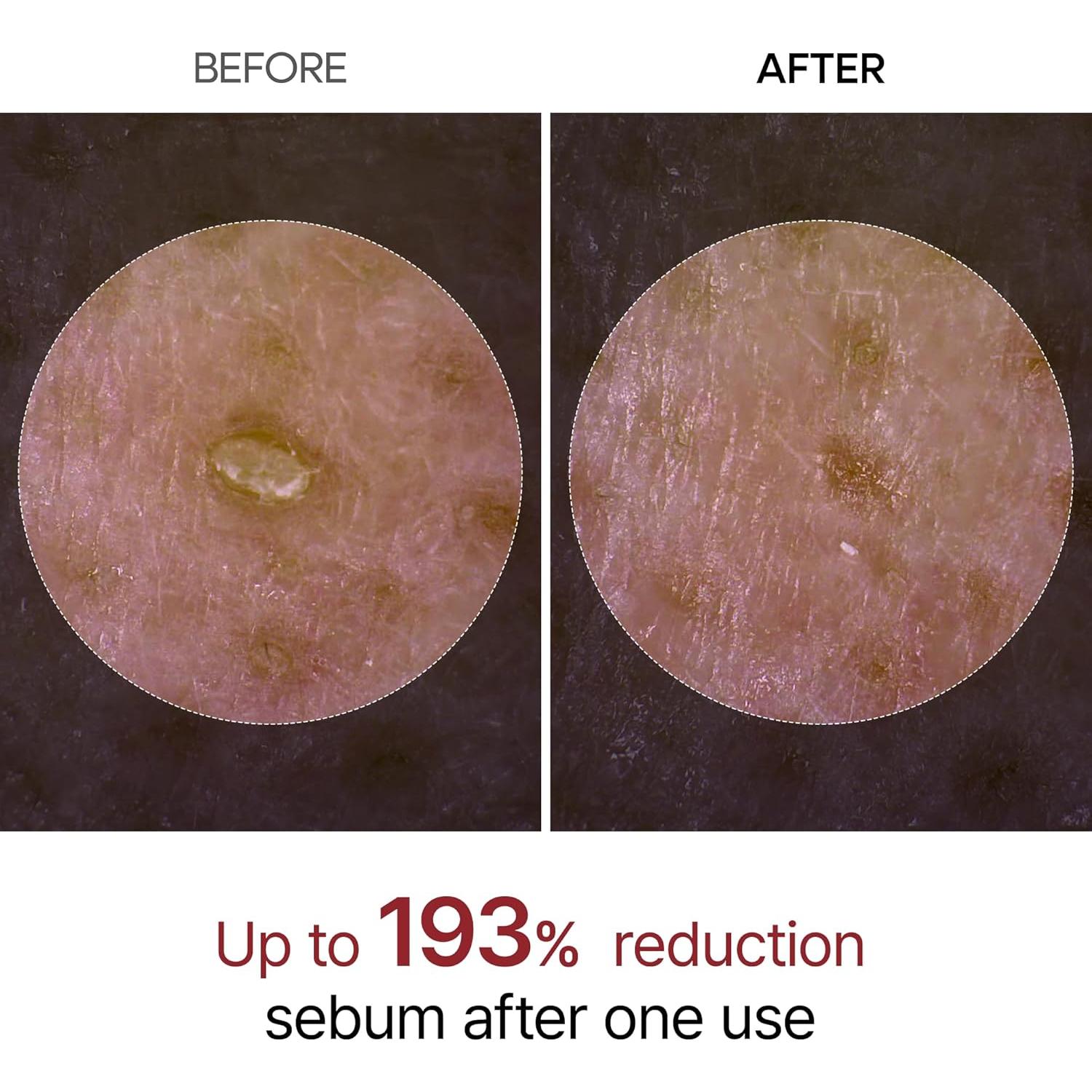 Ampoule Exfoliante Dr.Melaxin Glow Rice 80ml - Cuidado Piel