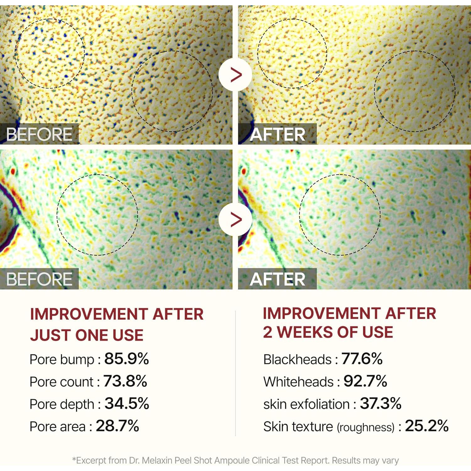 Ampoule Exfoliante Dr.Melaxin Glow Rice 80ml - Cuidado Piel