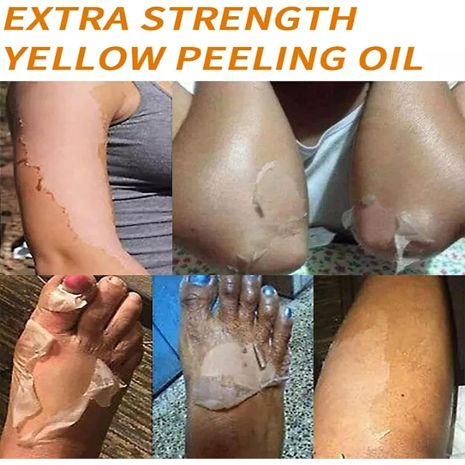 Aceite Exfoliante Amarillo Genérico 110ml - Todo Tipo de Piel