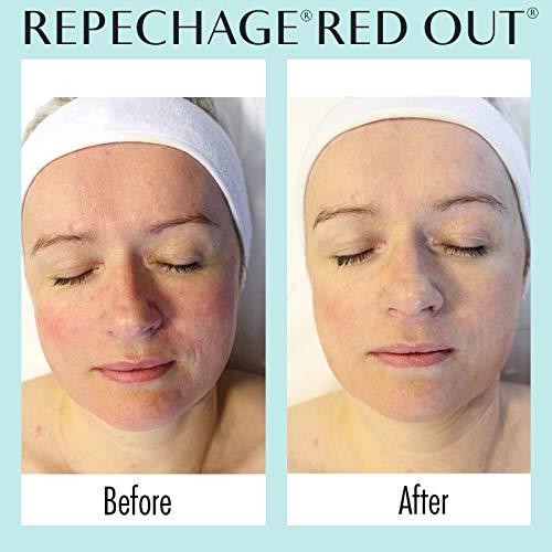 Suero Rojo Repechage 29.57 ml - Cuidado Piel Sensible y Rosácea