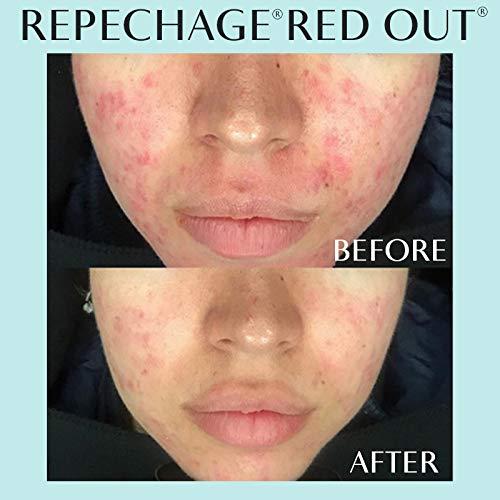 Suero Rojo Repechage 29.57 ml - Cuidado Piel Sensible y Rosácea