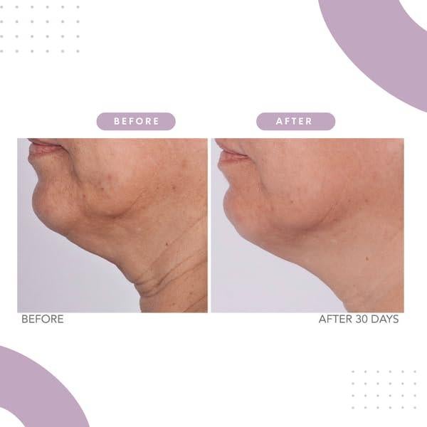 Crema Reafirmante Serious Skincare CORREC-CHIN 56.7g