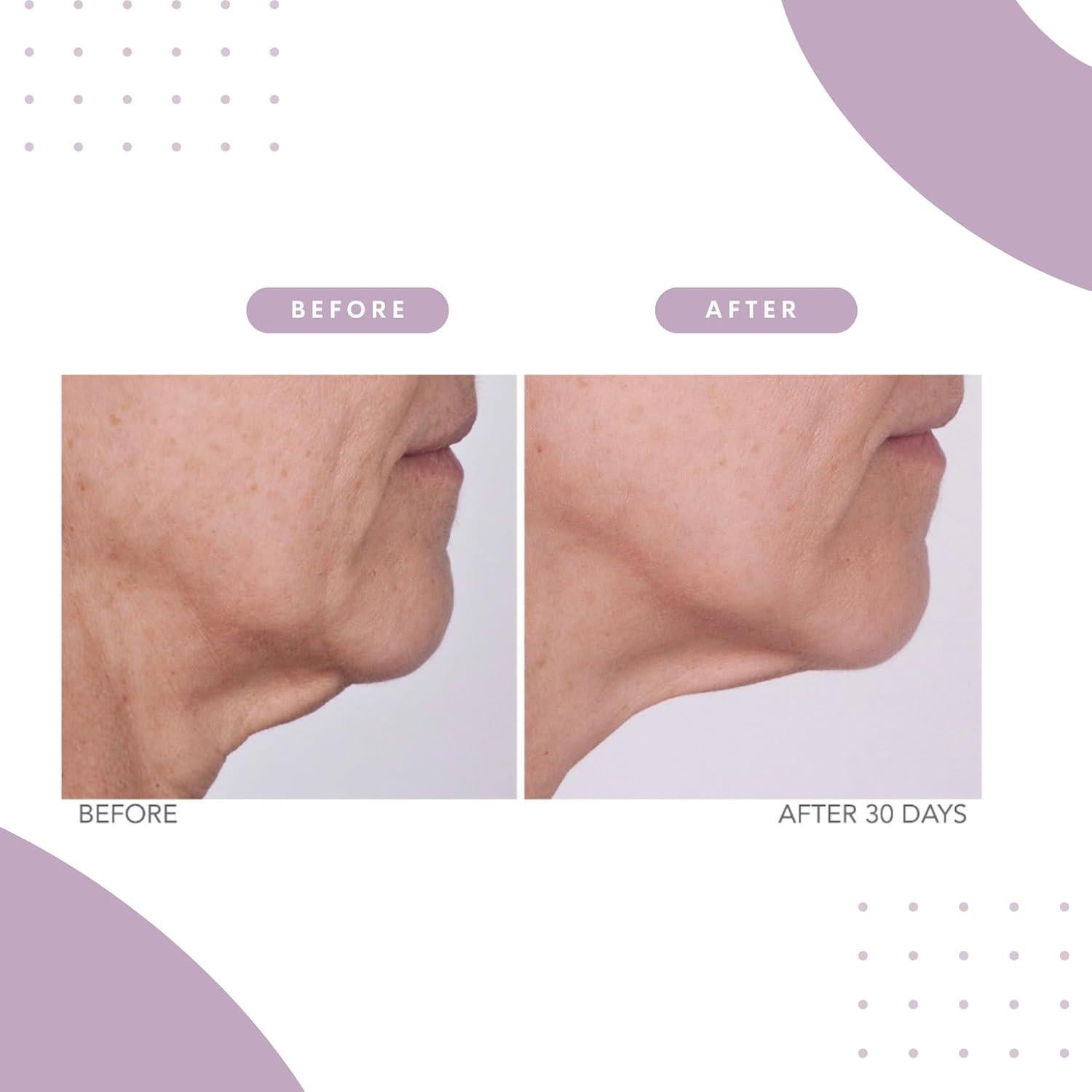 Crema Reafirmante Serious Skincare CORREC-CHIN 56.7g