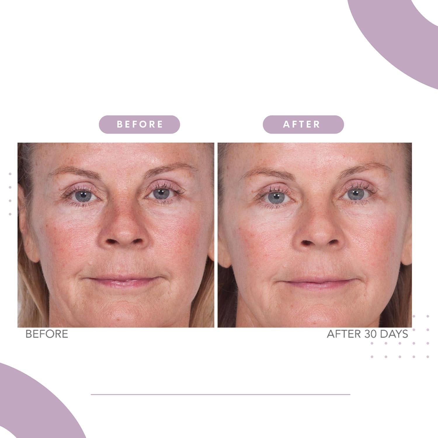 Suero Hidratante Reverse Lift Serious Skincare 29.57 ml