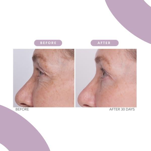 Crema para los Ojos Serious Skincare Reverse Lift 28.35g