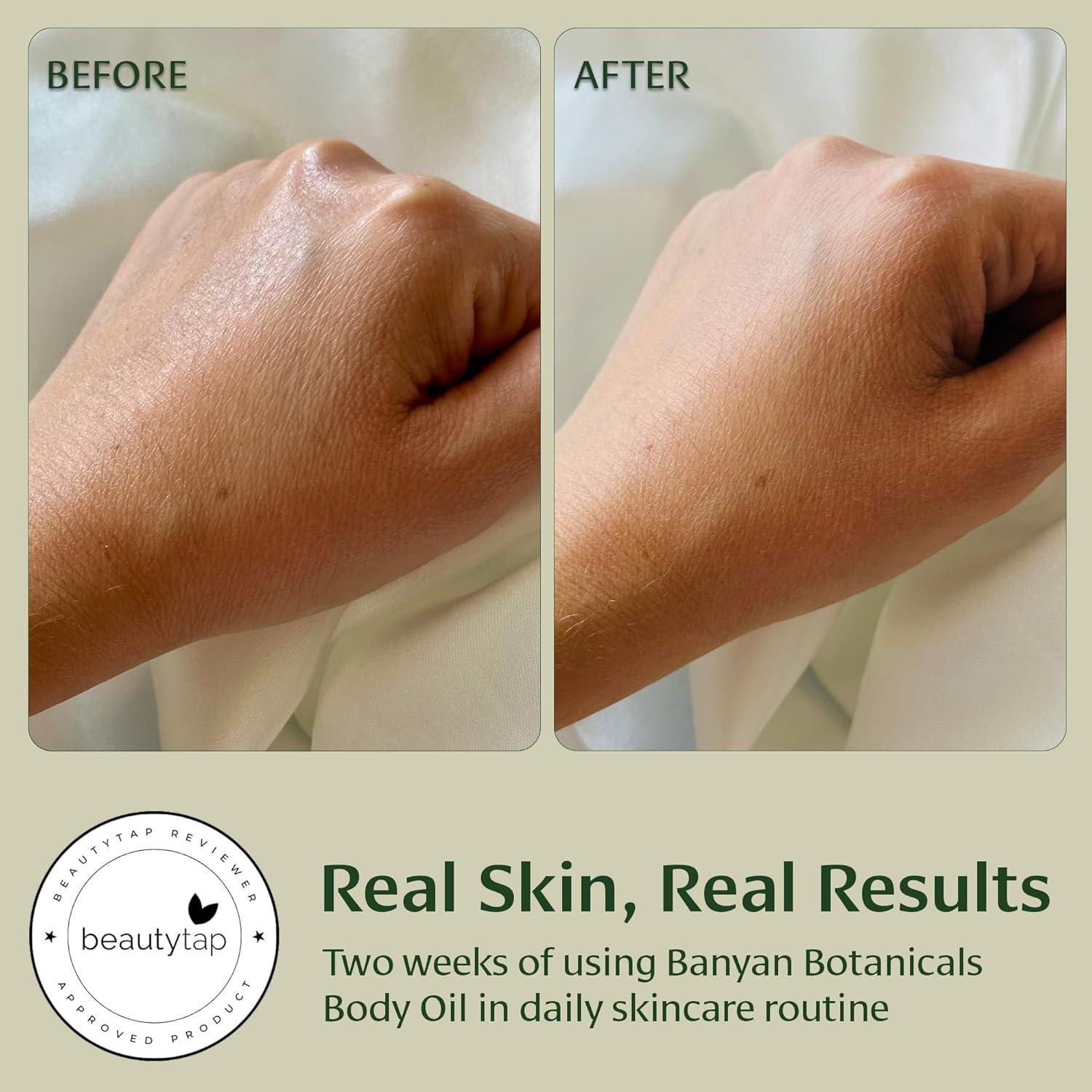 Aceite Corporal Ligero Banyan Botanicals 230 g - Cuidado Ayurvédico