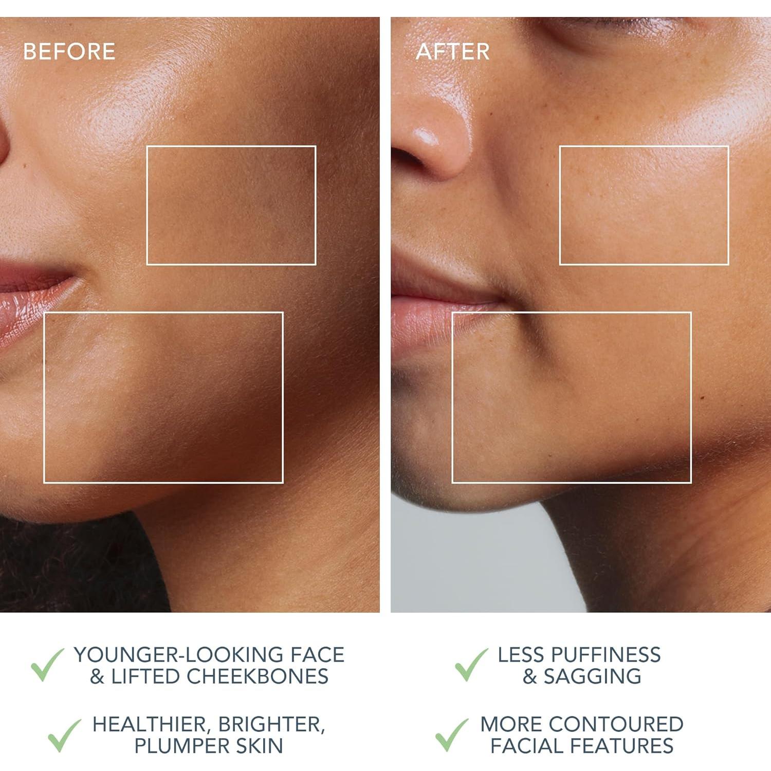 Dispositivo Facial de Microcorriente FOREO Bear 2 - Antienvejecimiento y Esculpido - Viajes