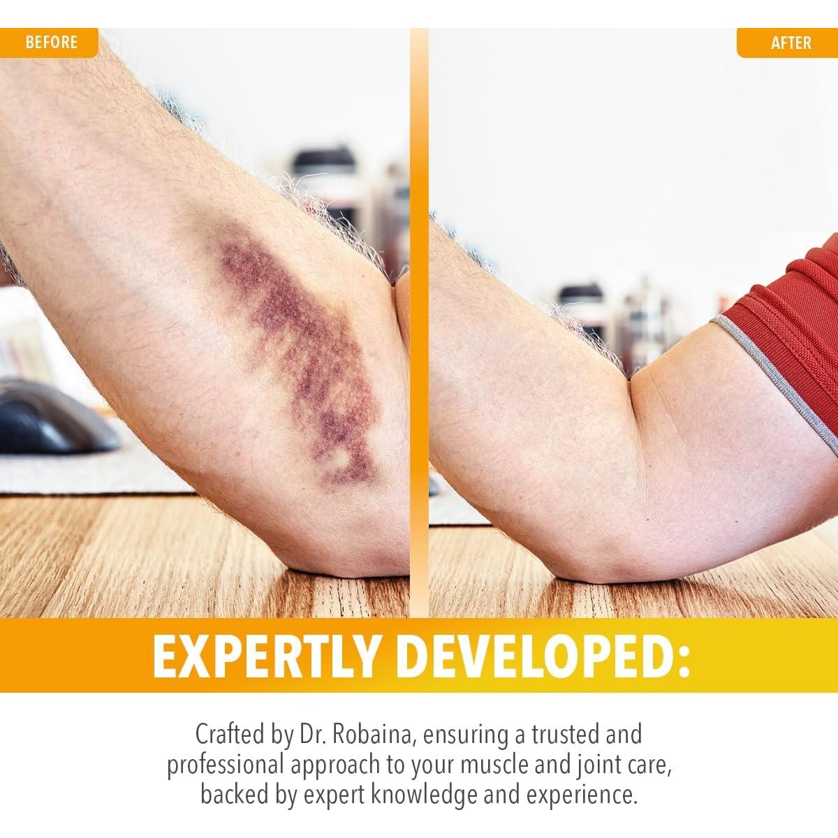 Crema para Moretones Dr. Robaina 113.4 g - Arnica y Vitamina K