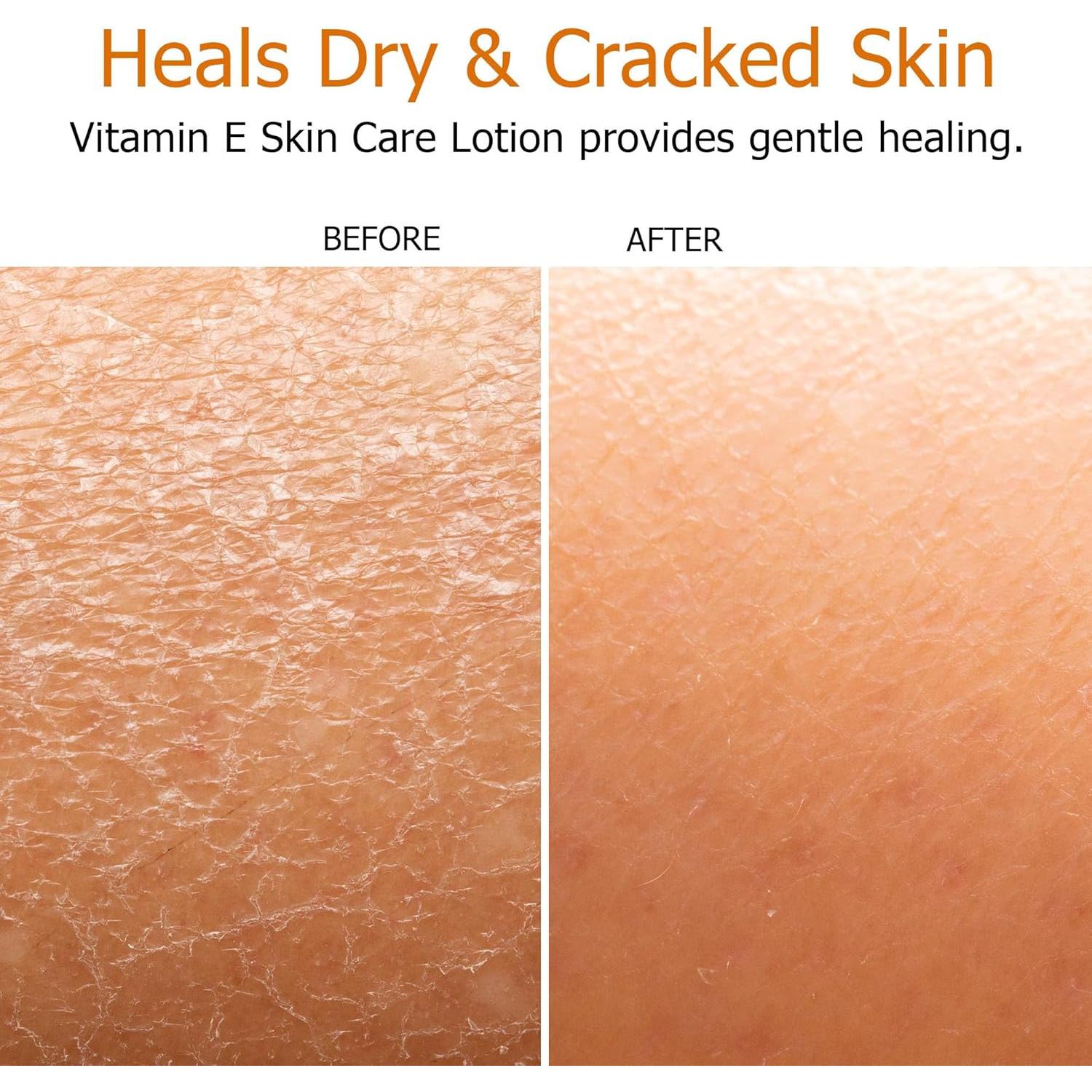 Loción de Vitamina E Fruit of the Earth 473 ml Hidratante