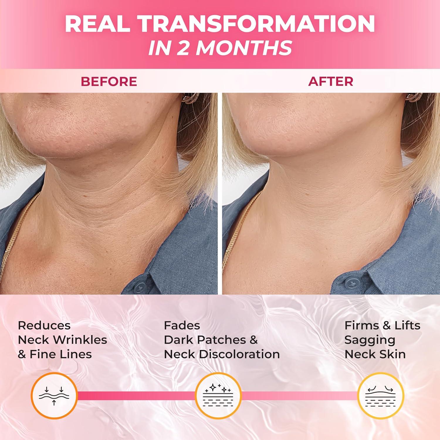 Crema Antienvejecimiento para Cuello ABERA 52.5 ml SPF 30+