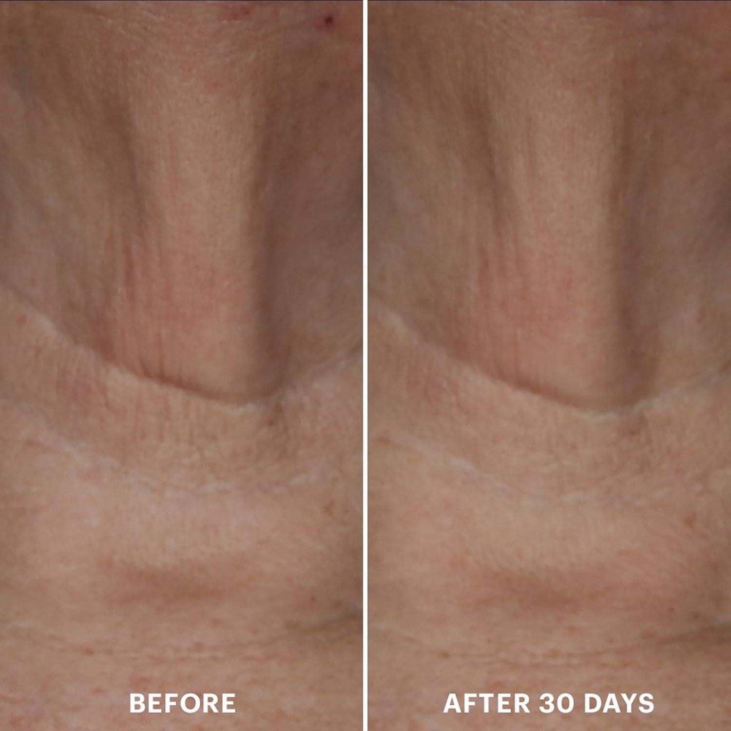 Crema para el Cuello Glo Skin Beauty Bio-Renew EGF 108g